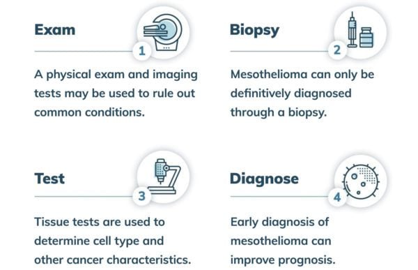 Chart showing the four steps of a mesothelioma diagnosis